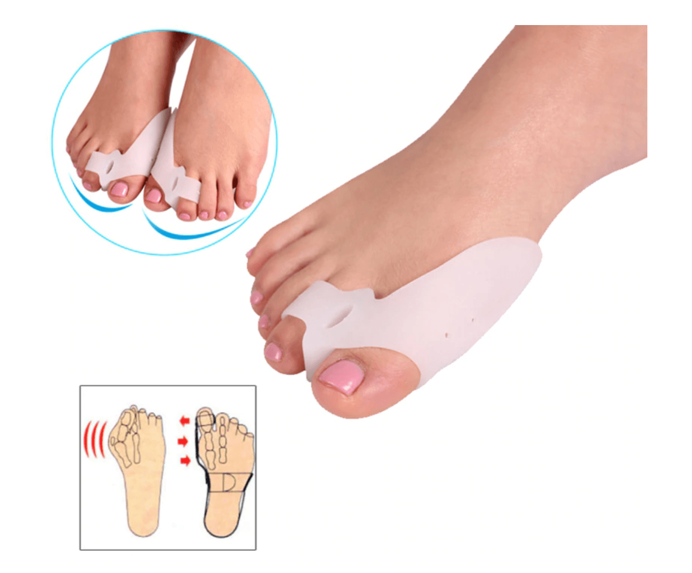 1 pair Toe Corrector Valgus Bunion Corrector (White) - Glowish