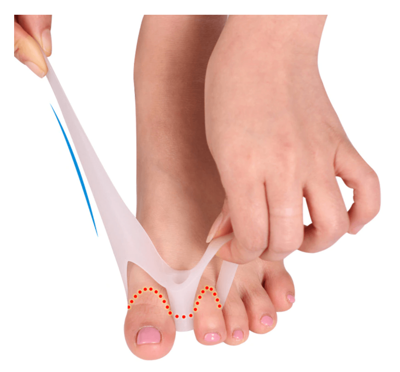1 pair Toe Corrector Valgus Bunion Corrector (White) - Glowish
