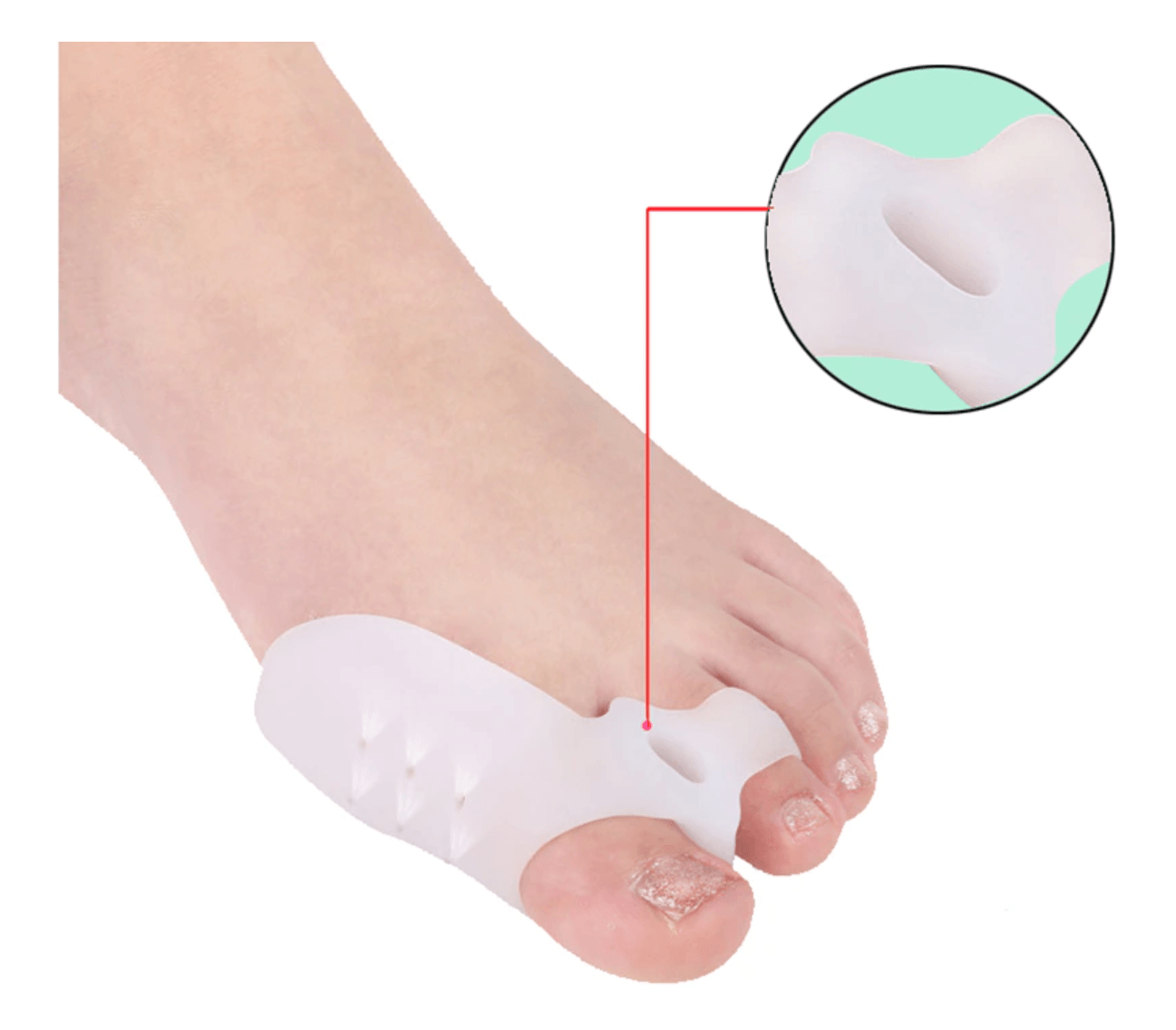 1 pair Toe Corrector Valgus Bunion Corrector (White) - Glowish