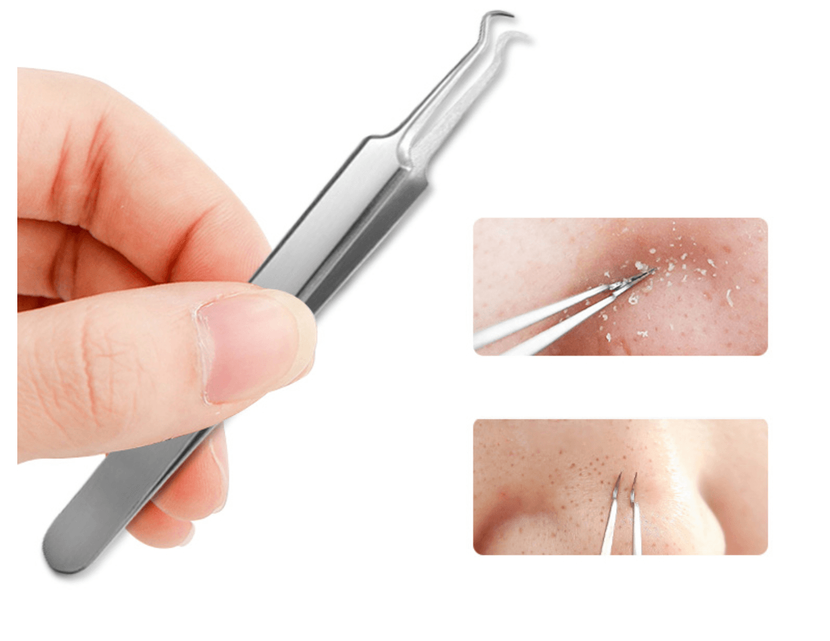 3Pcs Stainless steel Blackhead Acne Extractor - Glowish