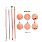 4PCS Acne Blackhead Pimple Black Spot Blemish Remover Tool - Glowish